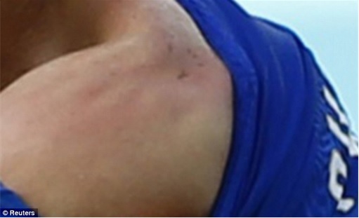2014 FIFA World Cup - Uruguay Luis Suárez Bites Claudio Marchisio 2 - Teeth Mark