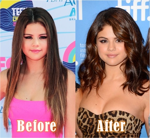Breast Enlargement - Selena Gomez