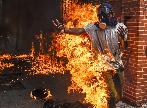 Venezuela Protester Burnt in Fire