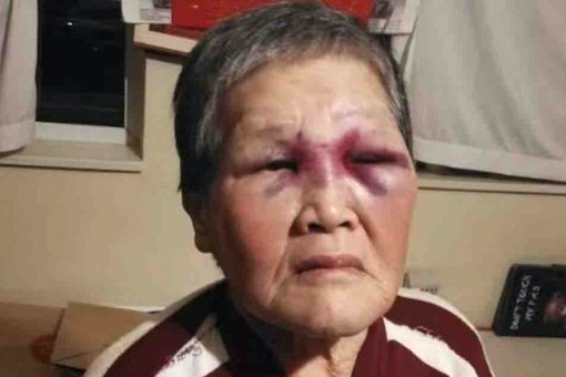 San Francisco Racist Attack - Chinese Grandma Xiao Zhen Xie