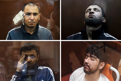 Missing Eye, Ear Shoved In Mouth & Electrocuted Genitals - ISIS Terrorists Pay Heavy Price For Terror Attack On Russia