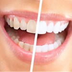 Rebuild Teeth With £10 Toothpaste, Here's The Catch ...