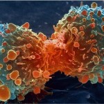 Reason Why People Get Cancer Found - It's Purely Bad Luck