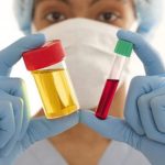 Japan Might Have An Easier Way To Detect Cancer - From Urine Samples