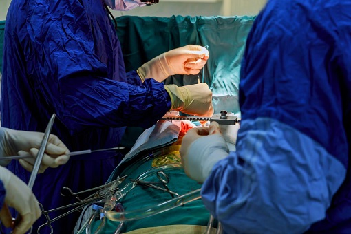 Discard Discriminative Laws So Malaysian Doctors Can Work - Cardiothoracic Surgeons